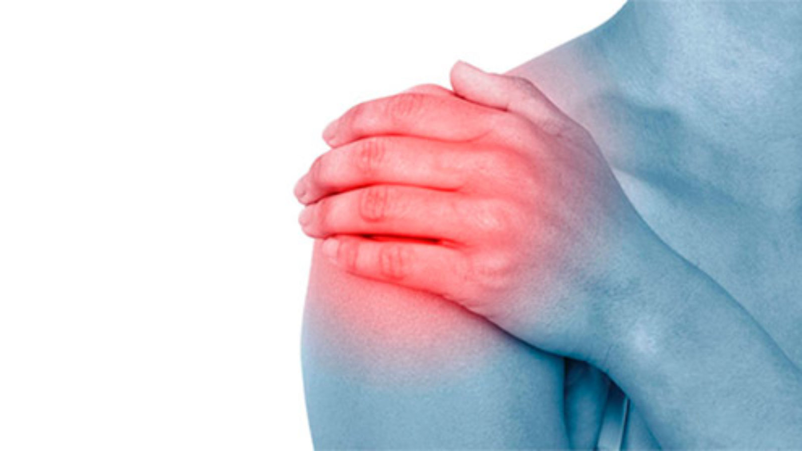 La lussazione della spalla è una fuoriuscita completa della spalla dalla sua sede naturale a seguito di sintomi di instabilità.