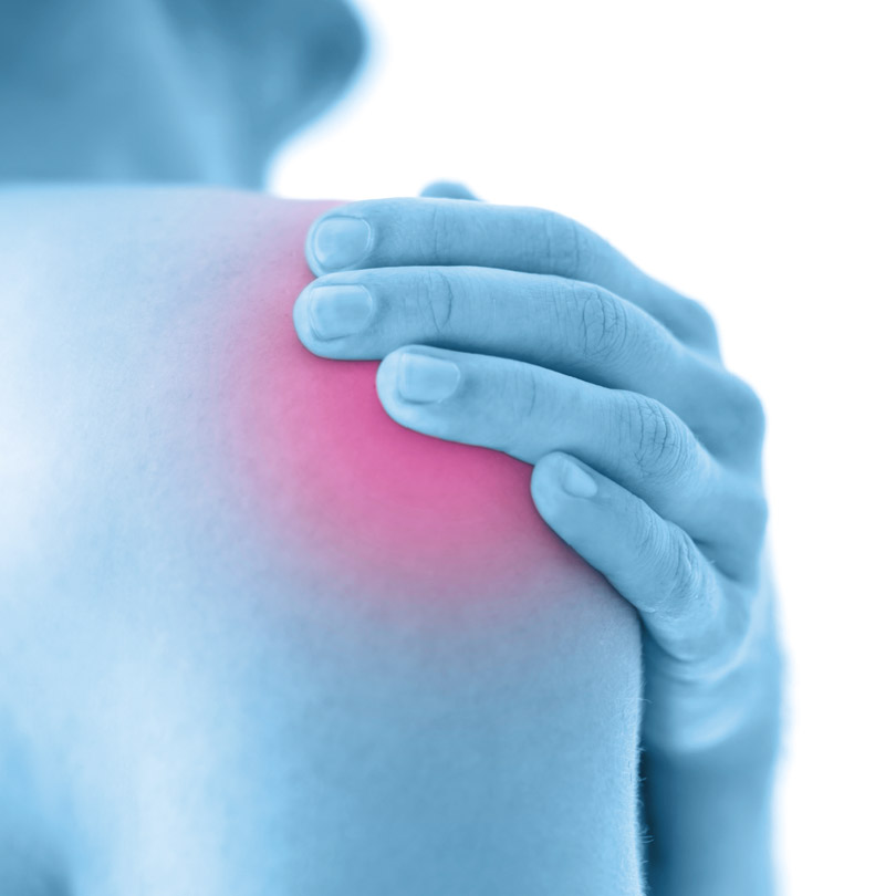 calcificazione della spalla