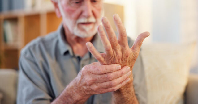 mano gonfia per atrosi