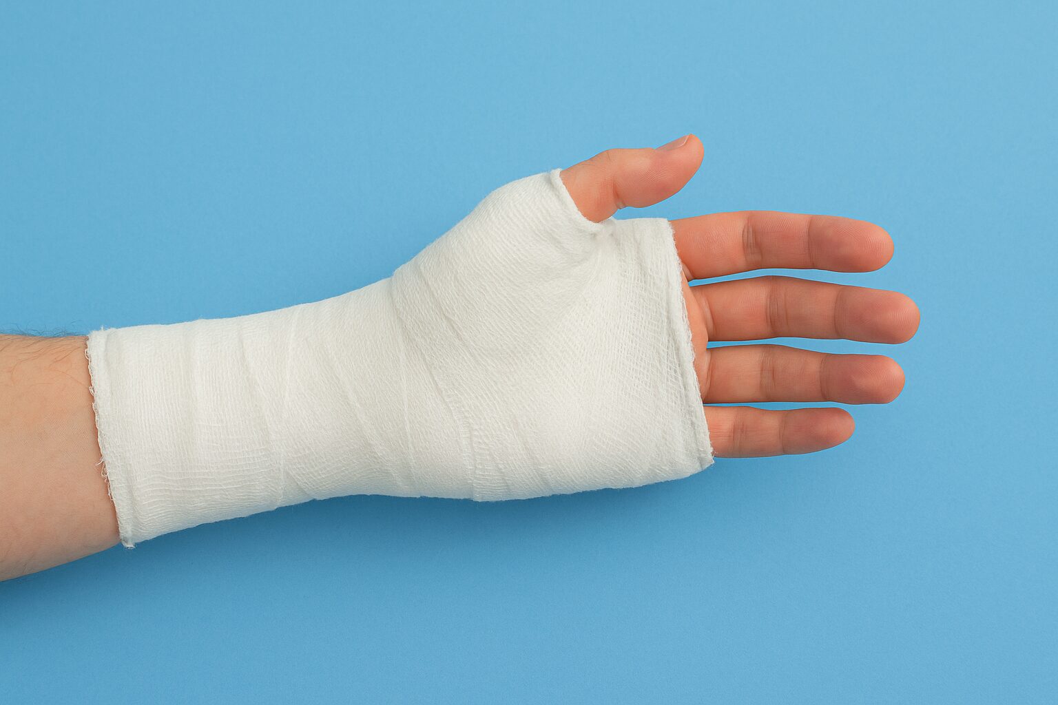 la frattura al metacarpo della mano