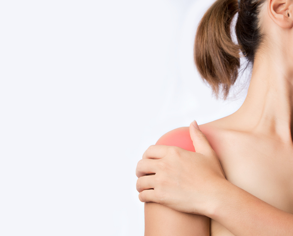 la calcificazione alla spalla su una giovane donna
