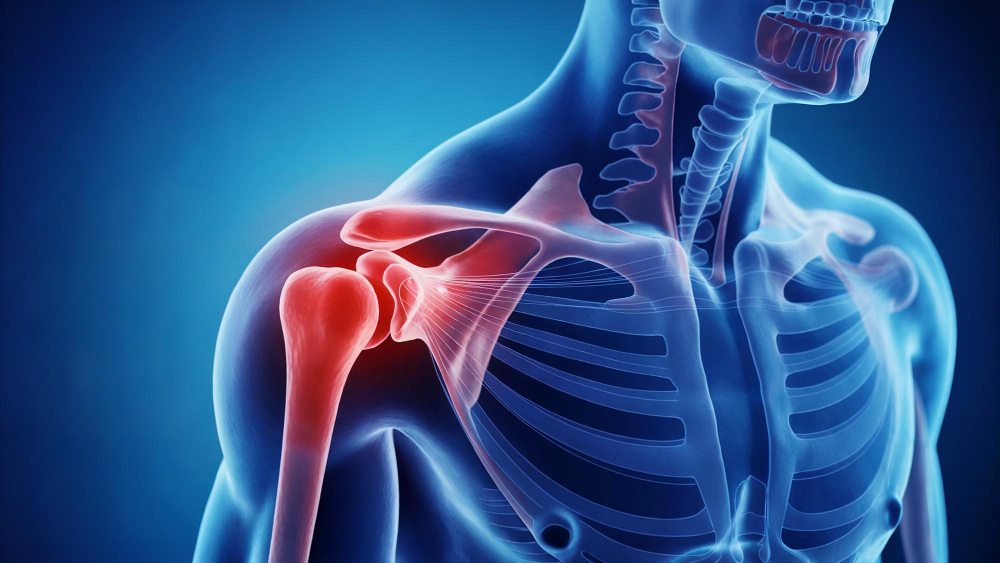 Intervento Protesi Spalla: Centro di Eccellenza con Liste di Attesa Brevi